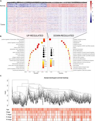 Identifying Biomarkers to Predict the Progression and Prognosis of Breast Cancer by Weighted Gene Co-expression Network Analysis